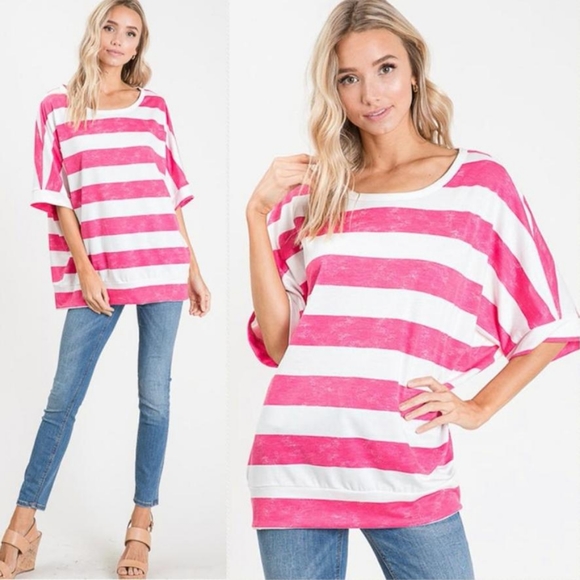 Striped Oversized Top - Picture 2 of 6
